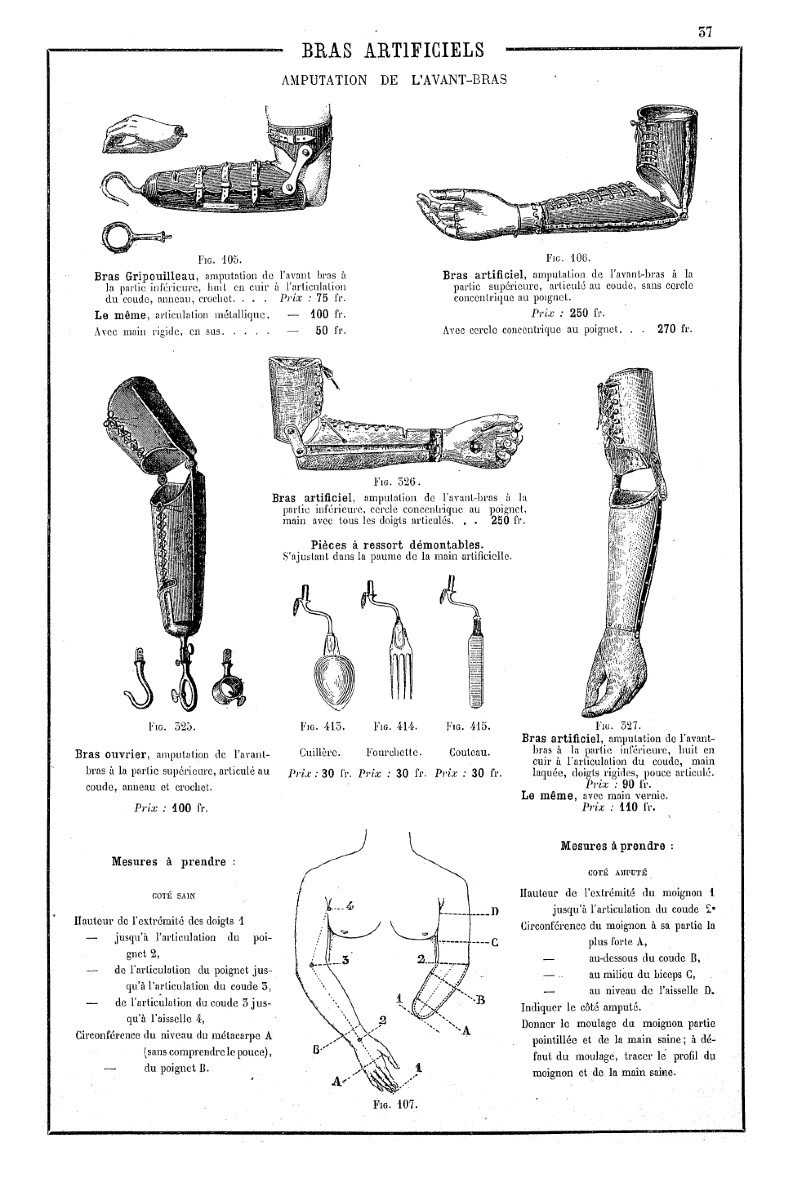 Prothèse avec articulation au coude après amputation de l’avant-bras. Début du XXéme siècle -photo-6