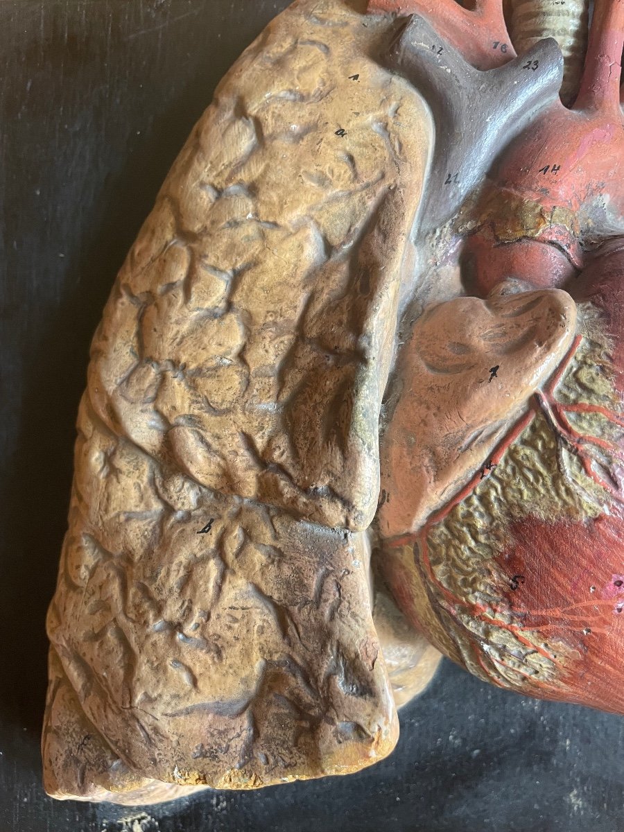 Beautiful Flayed Heart And Lungs Painted Plaster 19th-photo-1