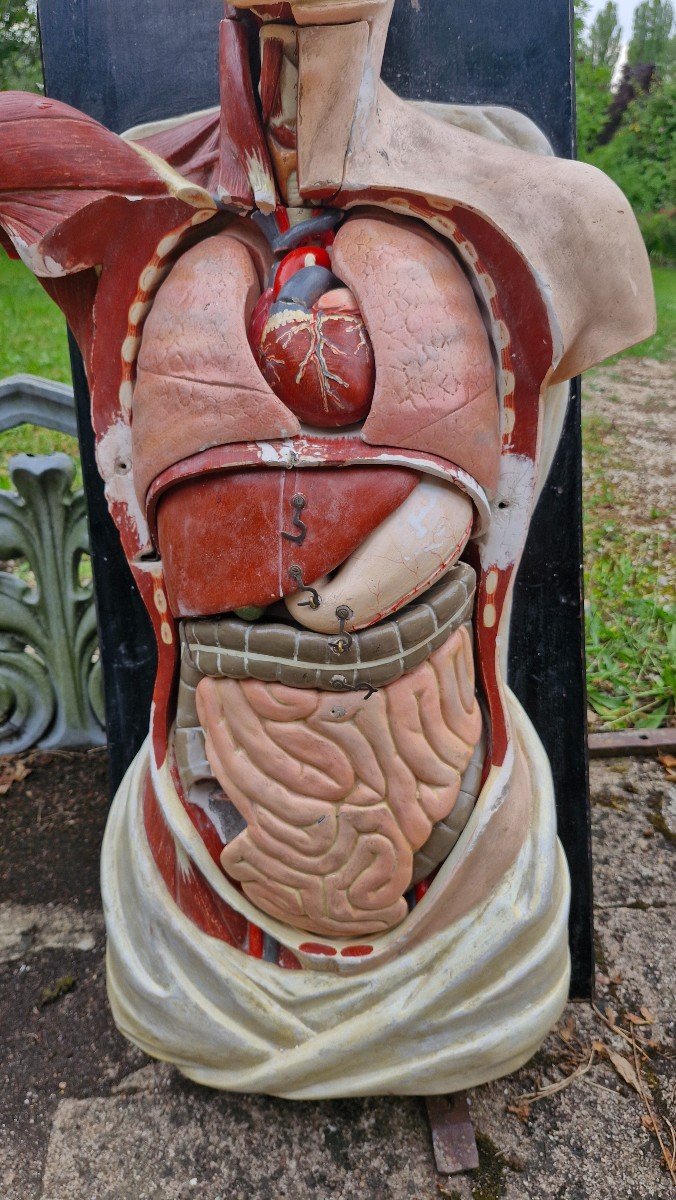 Old Medical Flayed-photo-4