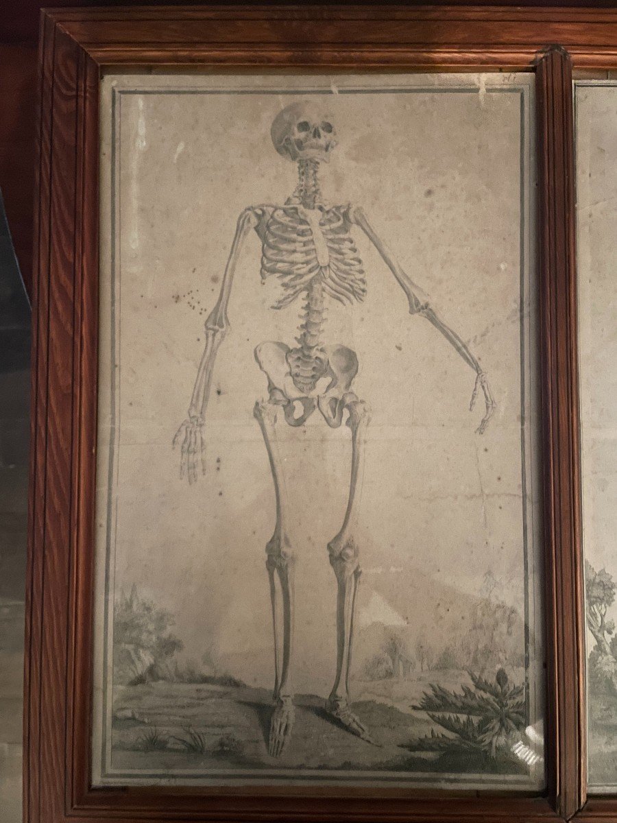 3 Skeletons - Anatomical Engravings In An XIX Pitchpin Frame-photo-2