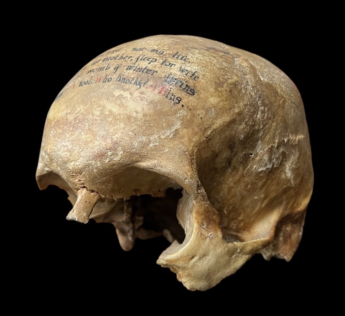 Rare Human Skull With Poem Written On The Forehead - European (english?) - 18/19th Century -photo-3