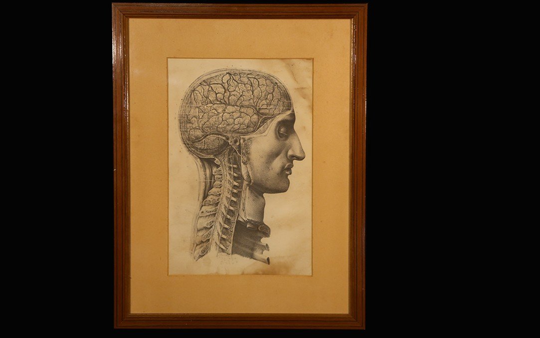 Lithograph, Anatomy Of Man After Bourgery, XIXth-photo-2