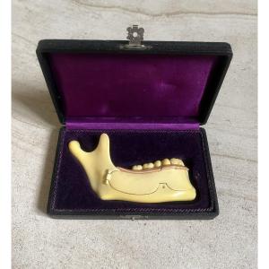 Object Of Curiosity Circa 1900 - Part Of Human Mandible In Galalith Or Bakelite
