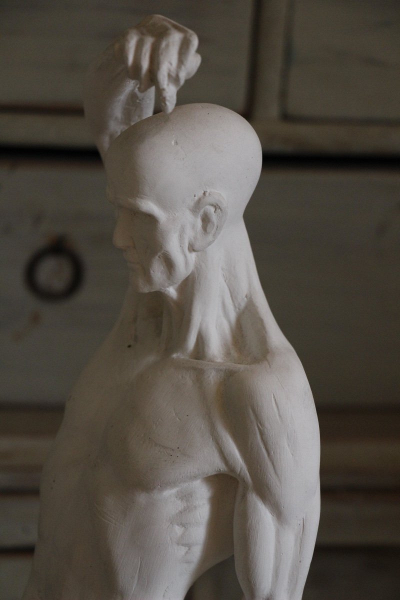 Flayed Men  In Plaster -photo-3