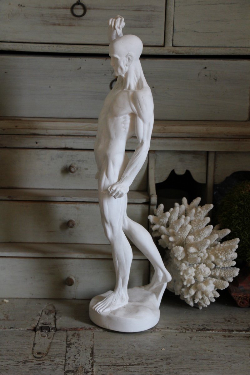 Flayed Men  In Plaster 