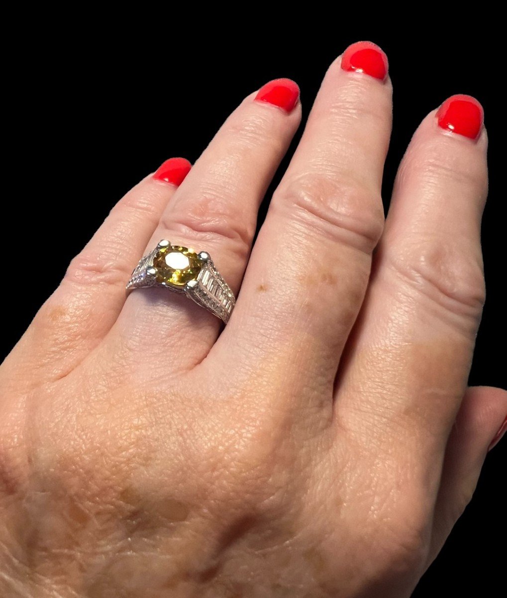 Gold, Yellow Sapphire And Diamond Ring-photo-3