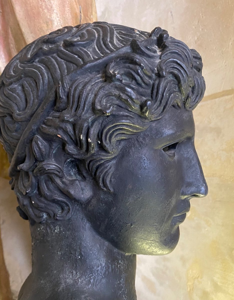 Head Of A Winning Athlete, Patinated Plaster From Antiquity -photo-4