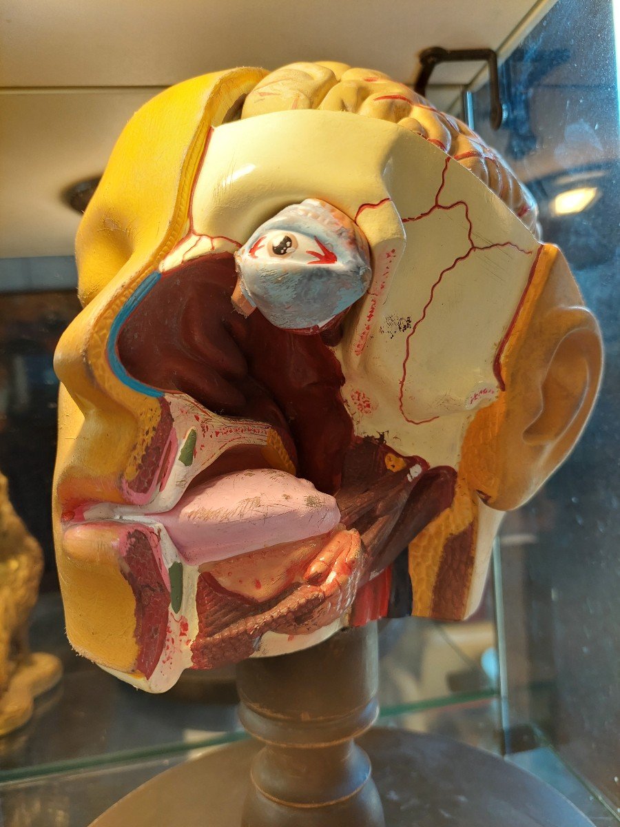 Flayed Skull And Brain Organs-photo-2