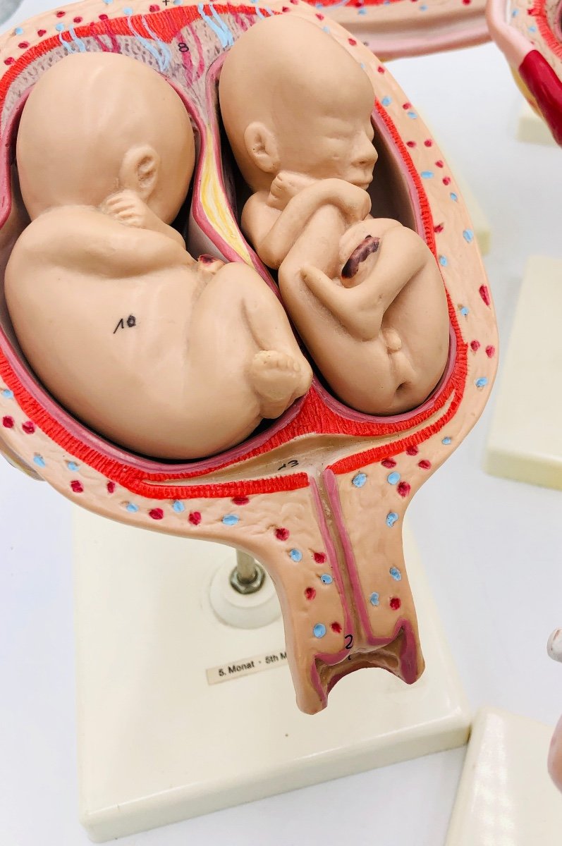 Modèles Anatomiques De L’ėvolution Du Foetus -photo-4