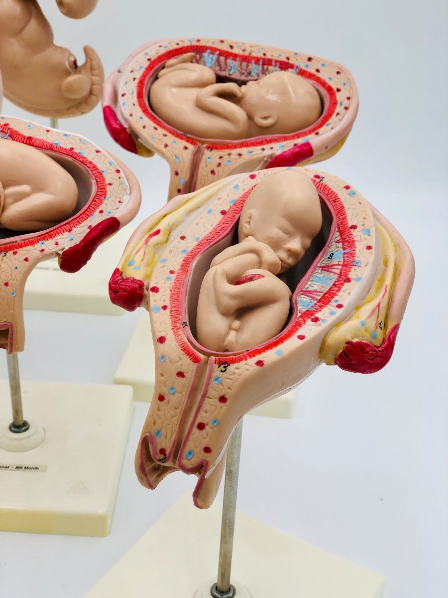 Modèles Anatomiques De L’ėvolution Du Foetus -photo-5