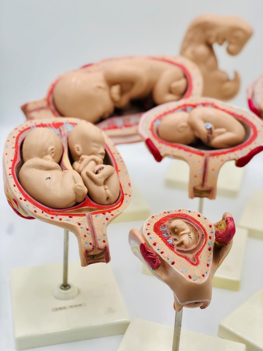 Modèles Anatomiques De L’ėvolution Du Foetus -photo-6