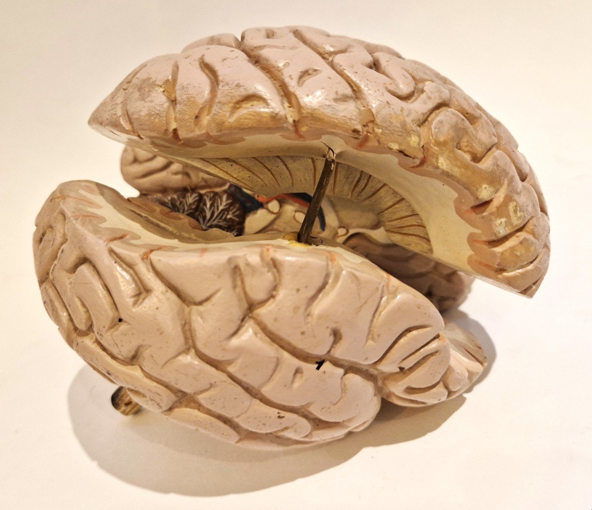 Plaster Brain Model, Mid-20th Century-photo-4