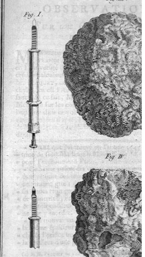 Silver And Silver-gilt Ophthalmology, 18th Century-photo-1