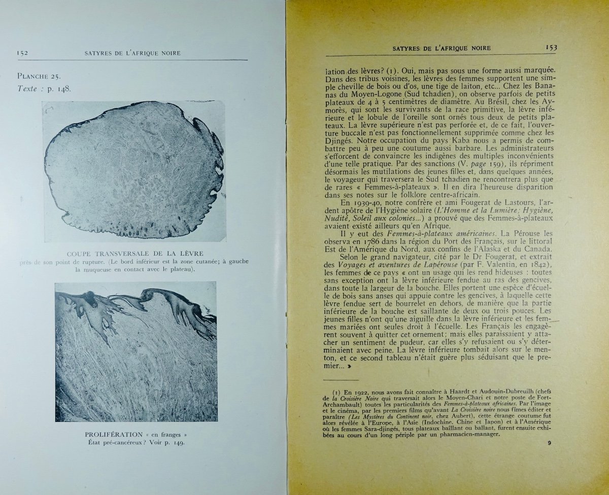 MURAZ (Docteur Gaston) - Satyres illustrées de l'Afrique noire. Broché, 1947.-photo-4