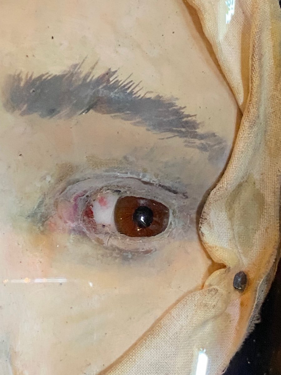 Divergent Strabismus, Anatomical Study In Paper Mache Circa 1900-photo-4