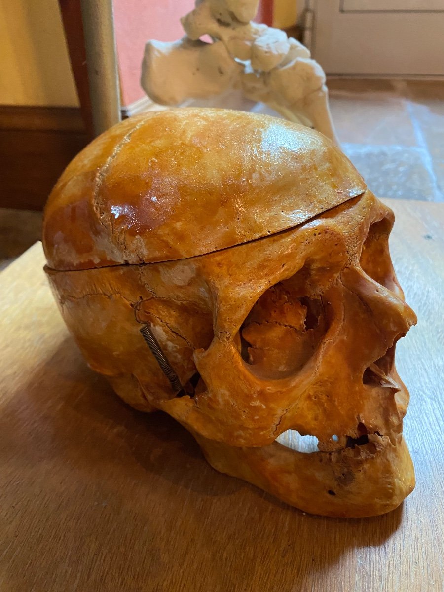 Old Medicalized Skull, Pedagogue From The 19th Century -photo-3