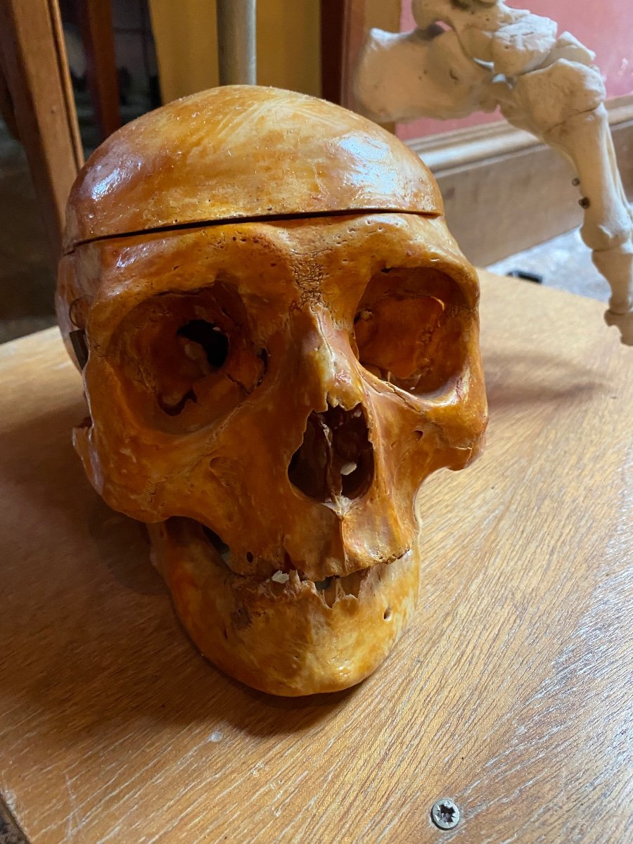 Ancien Crâne Médicalisé, Pédagogue Du XIX Eme Siècle -photo-1