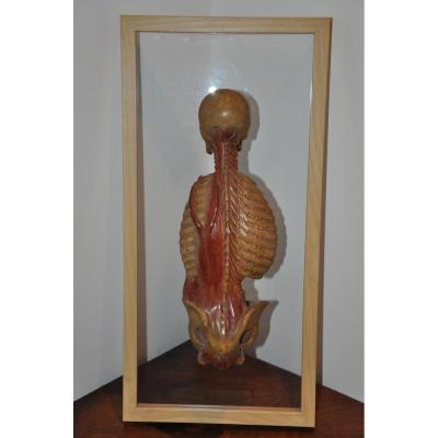 Skinned Anatomical Nineteenth Century: Back Cut