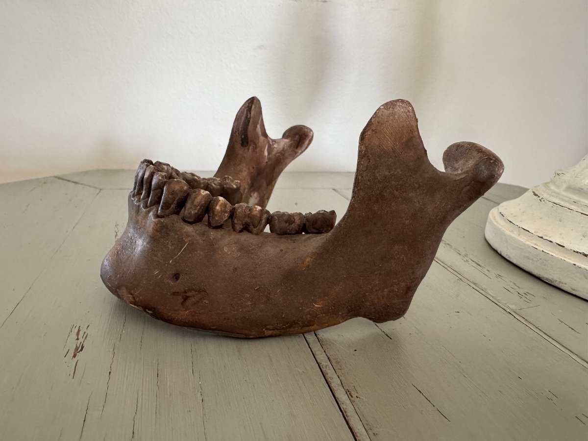 Memento Mori Terracotta Jaw End Of 19th Early 20th Century Perfect Condition-photo-4