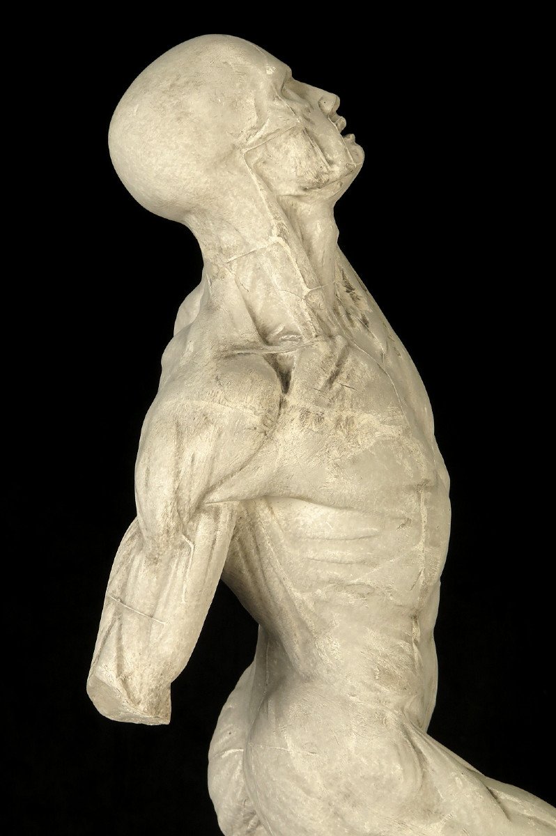 Ancient Flayed In Plaster By Eugène Caudron C.1850 / Anatomy Human Science Cabinet Curiosity-photo-2