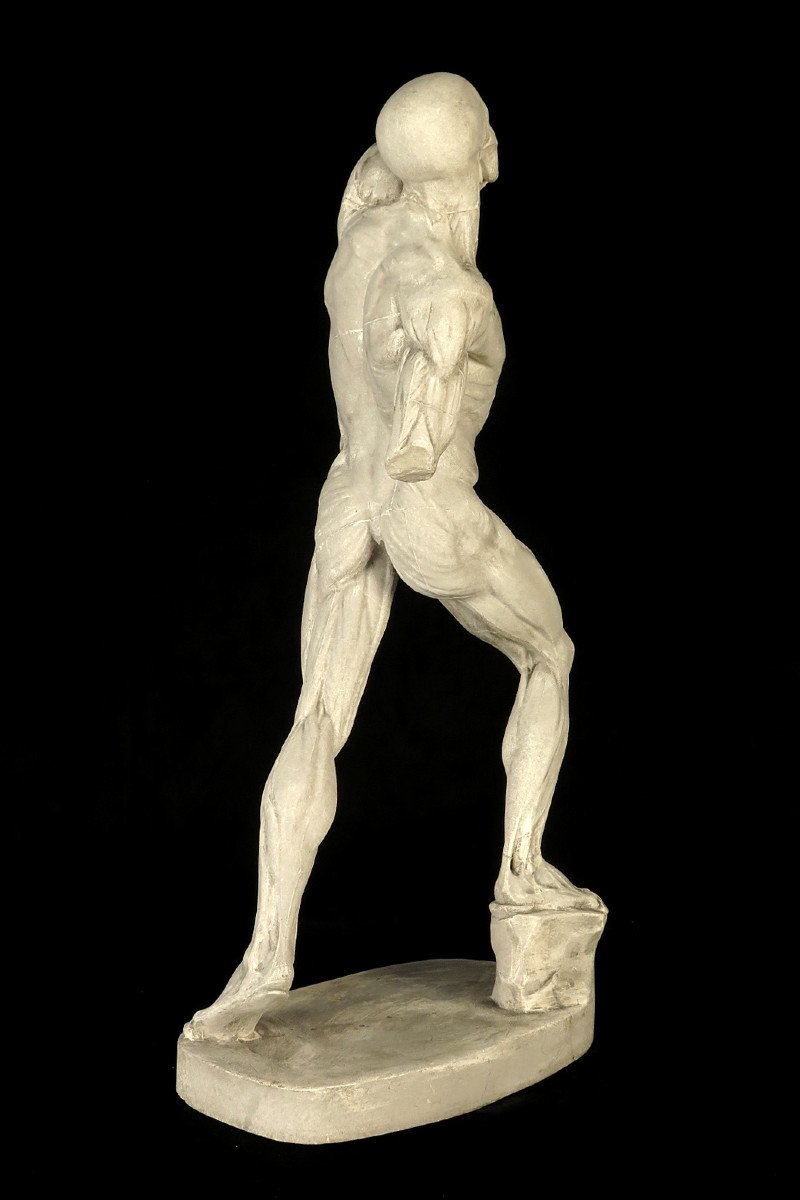 Ancient Flayed In Plaster By Eugène Caudron C.1850 / Anatomy Human Science Cabinet Curiosity-photo-4