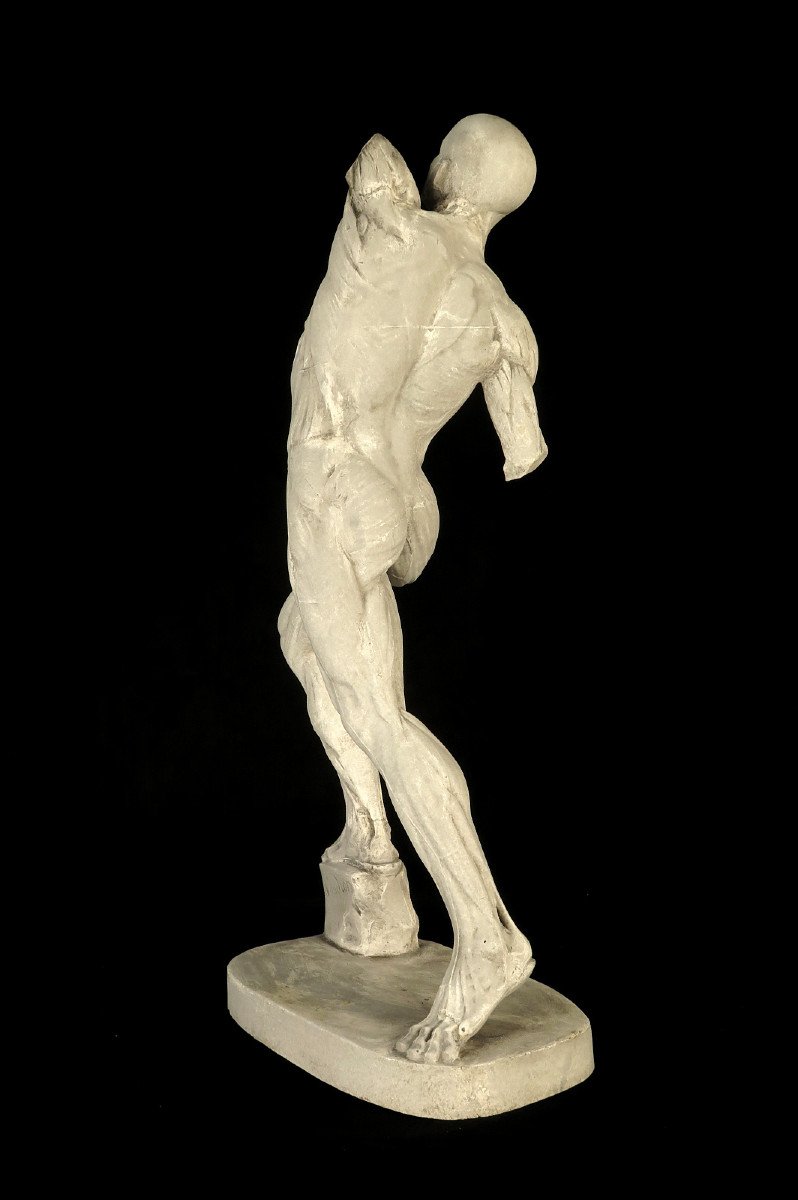 Ancient Flayed In Plaster By Eugène Caudron C.1850 / Anatomy Human Science Cabinet Curiosity-photo-1
