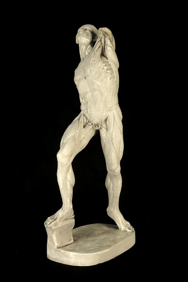Ancient Flayed In Plaster By Eugène Caudron C.1850 / Anatomy Human Science Cabinet Curiosity-photo-4