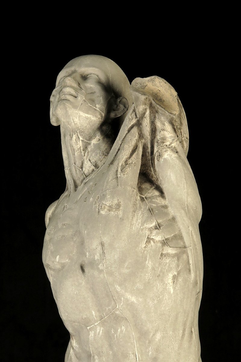 Ancient Flayed In Plaster By Eugène Caudron C.1850 / Anatomy Human Science Cabinet Curiosity-photo-5