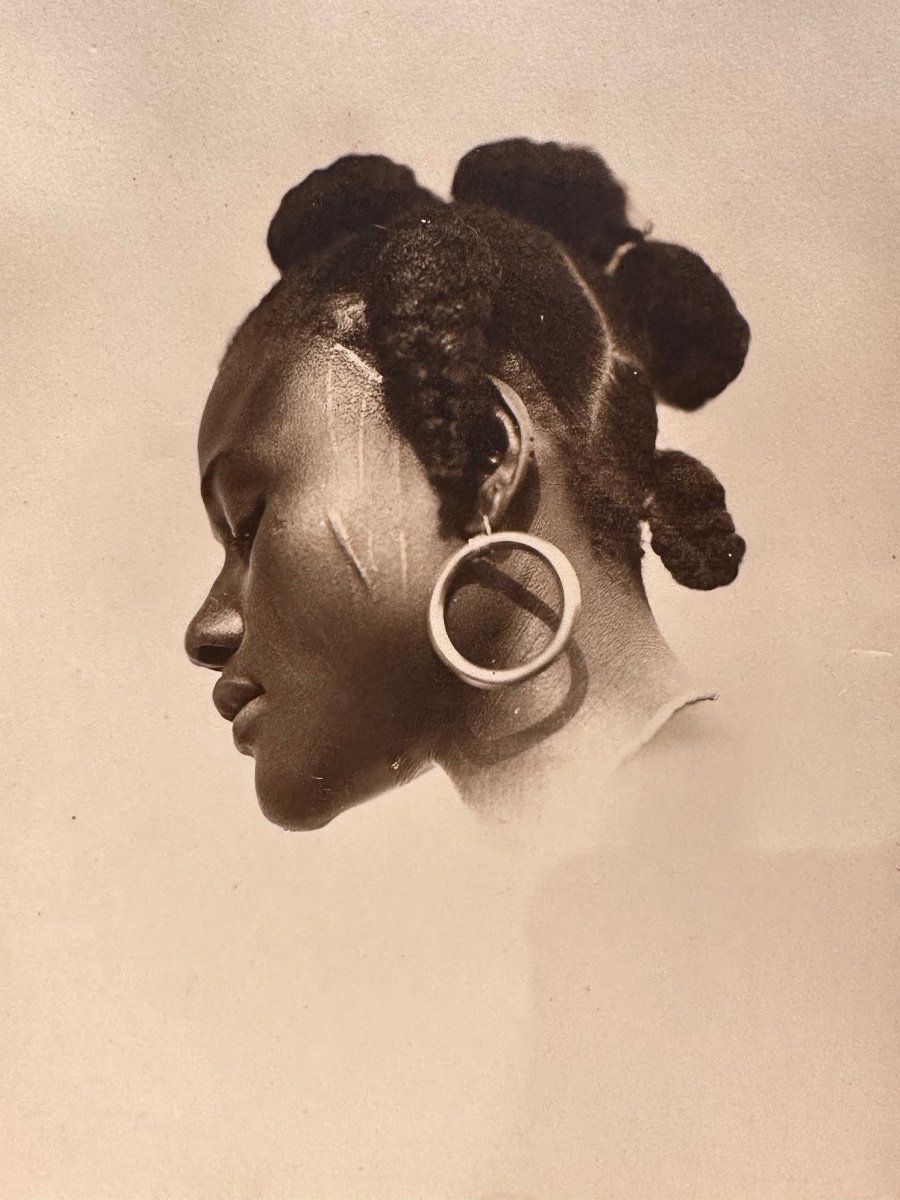 Portrait Of A Young  Woman With A Scarred Face. Africa, Ca. 1930 -photo-2