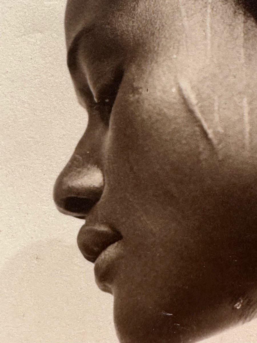 Portrait Of A Young  Woman With A Scarred Face. Africa, Ca. 1930 -photo-1