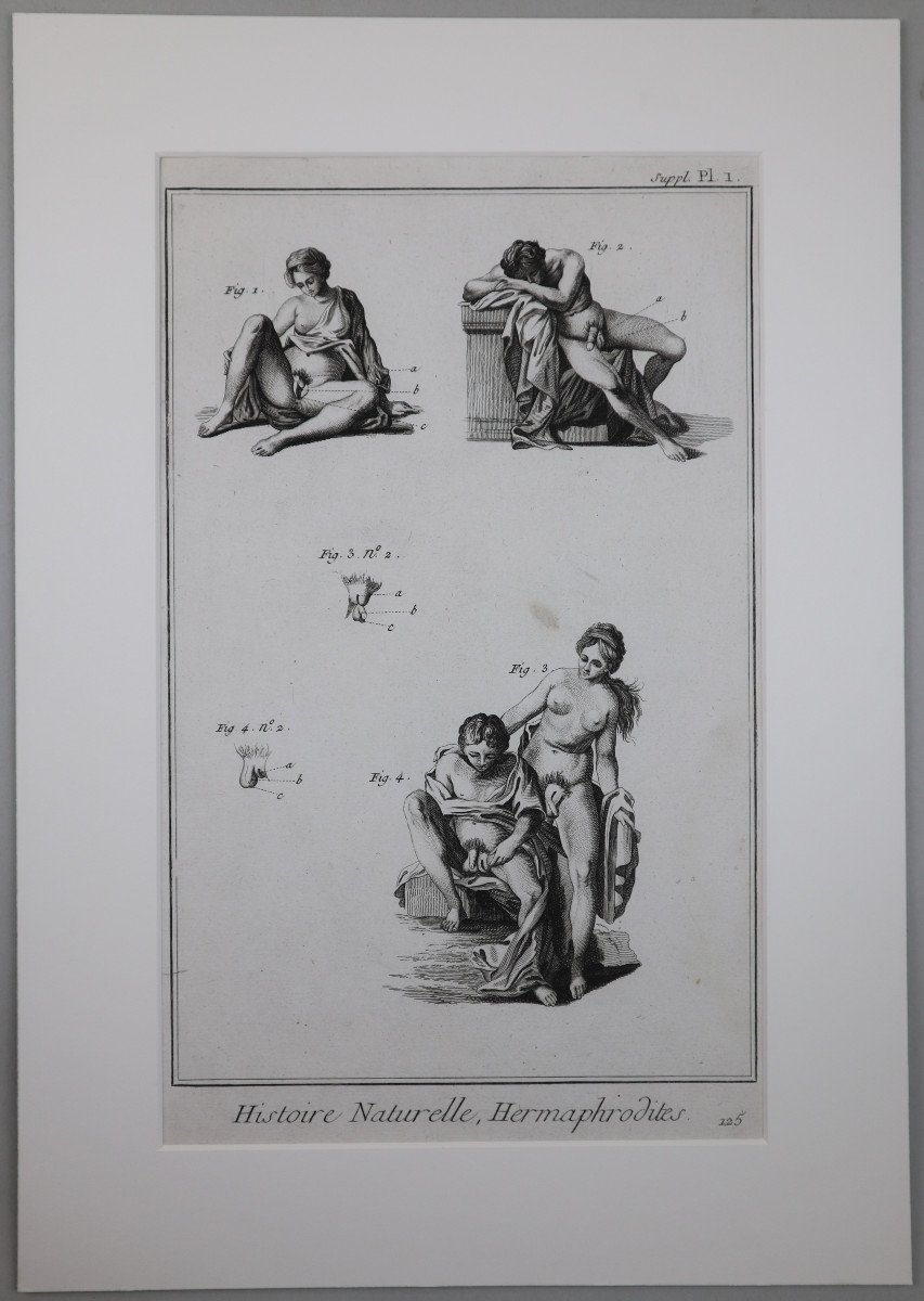 Hermaphrodites. Trois Planches Originales De l'Encyclopédie De Diderot Et d'Alembert.-photo-2