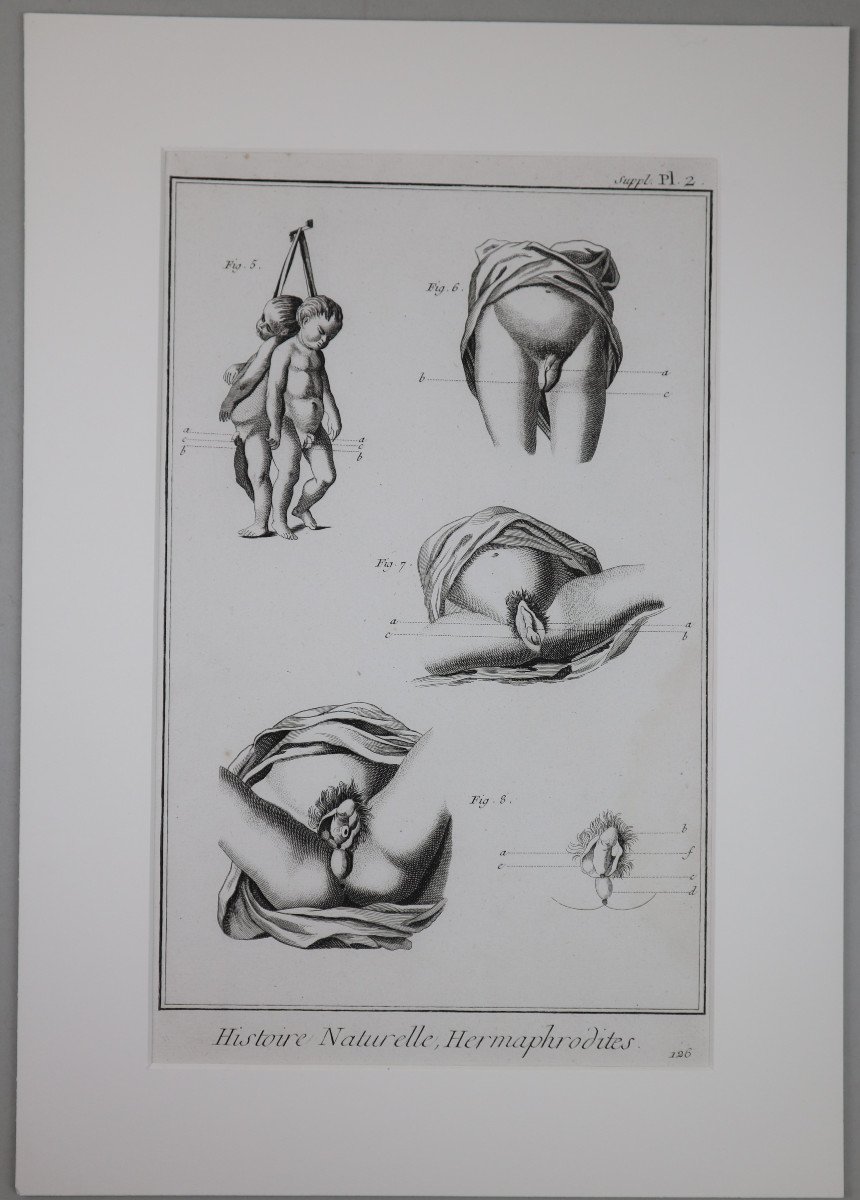 Hermaphrodites. Trois Planches Originales De l'Encyclopédie De Diderot Et d'Alembert.-photo-3