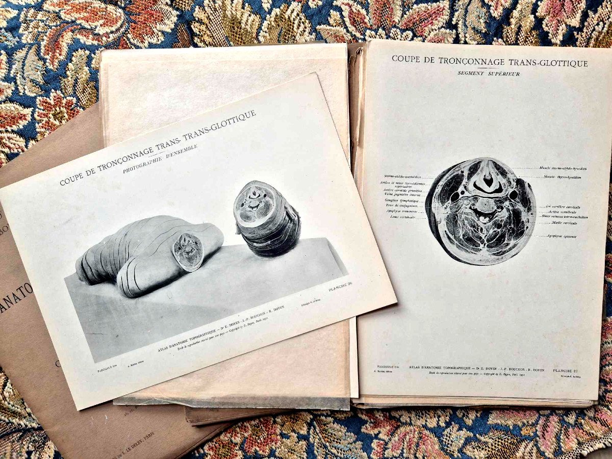 Atlas Of Topographic Anatomy 1911 – 3 Illustrated Booklets – Medicine And Curiosity-photo-3