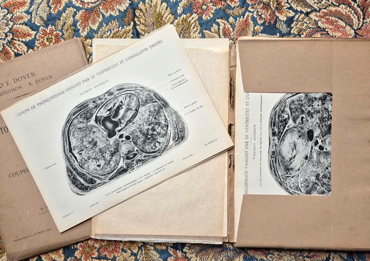 Atlas Of Topographic Anatomy 1911 – 3 Illustrated Booklets – Medicine And Curiosity-photo-4